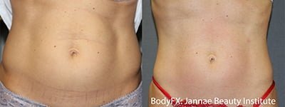 BODYFX