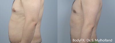 BODYFX